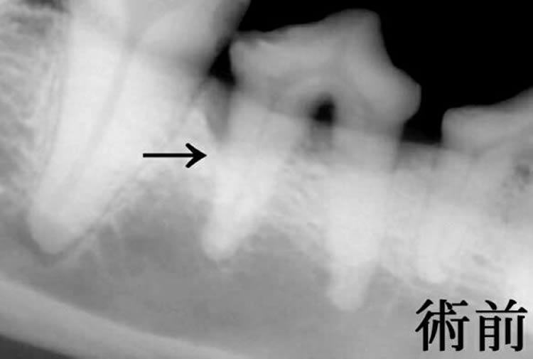 手術前の歯科X線検査