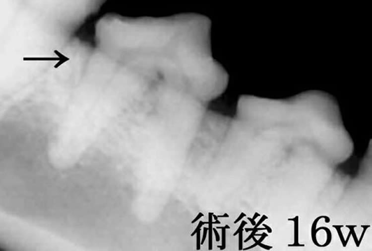 手術後4ヶ月の歯科X線検査